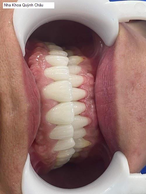 Hình ảnh Nha Khoa Quỳnh Châu